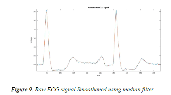 biomedres-median-filter