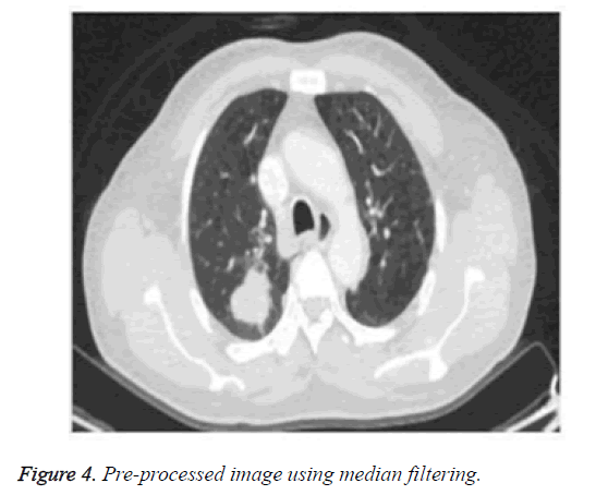 biomedres-median-filtering