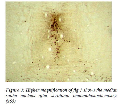 biomedres-median-nucleus-serotonin