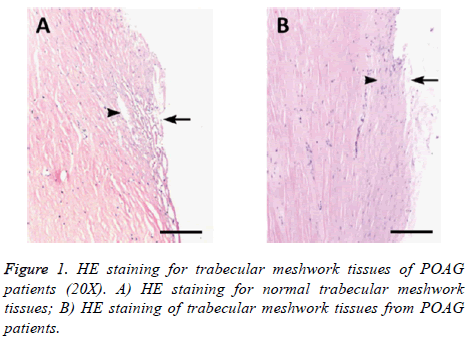 biomedres-meshwork-tissues