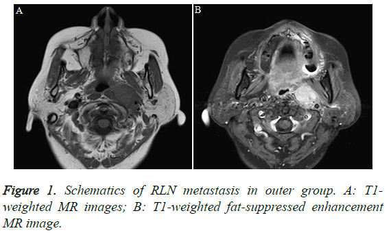 biomedres-metastasis-outer