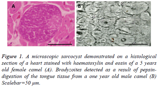 biomedres-microscopic-sarcocyst