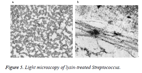 biomedres-microscopy-Streptococcus