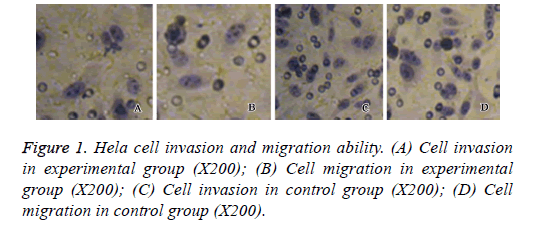 biomedres-migration-ability