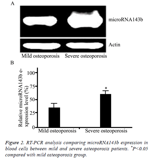 biomedres-mild-osteoporosis