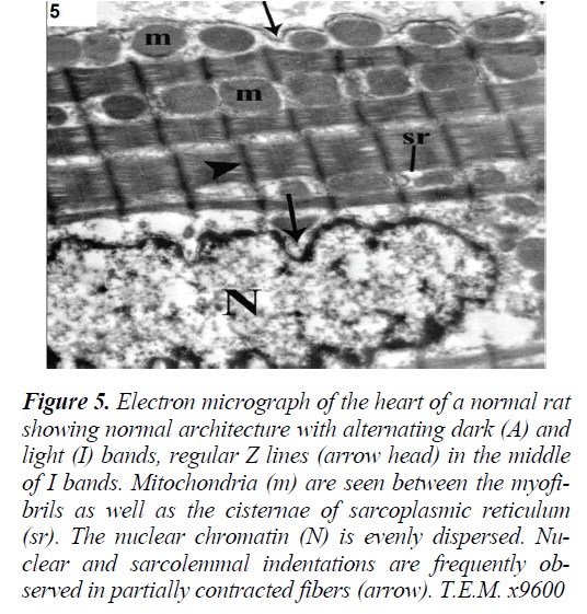 biomedres-minimal-Electron-micrograph