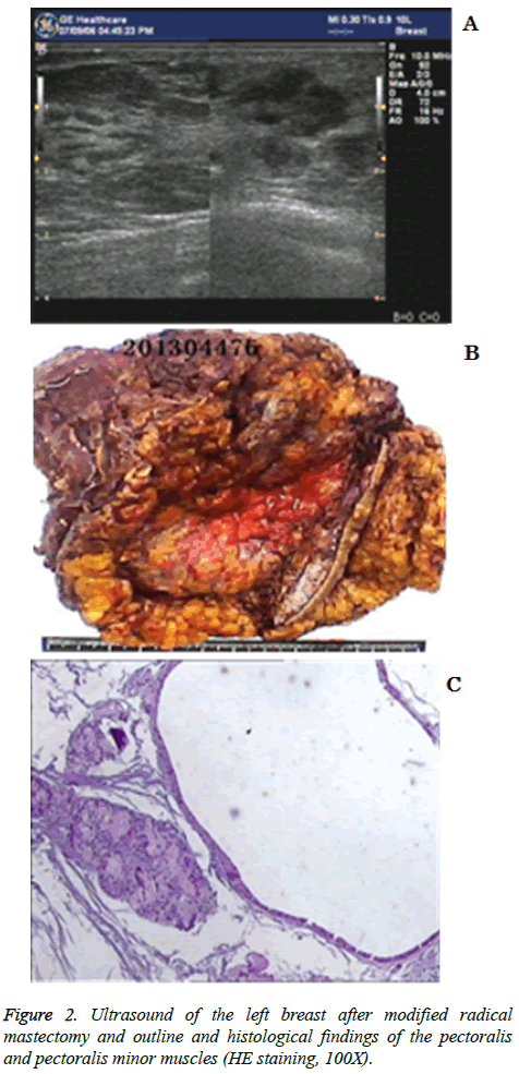 biomedres-minor-muscles