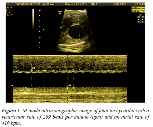 biomedres-mode-ultrasonographic