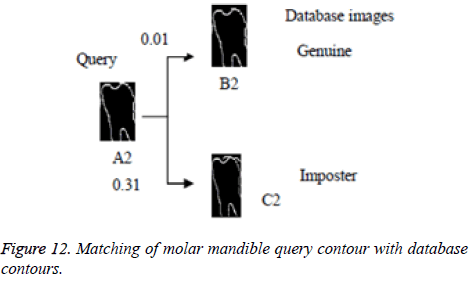 biomedres-molar-mandible