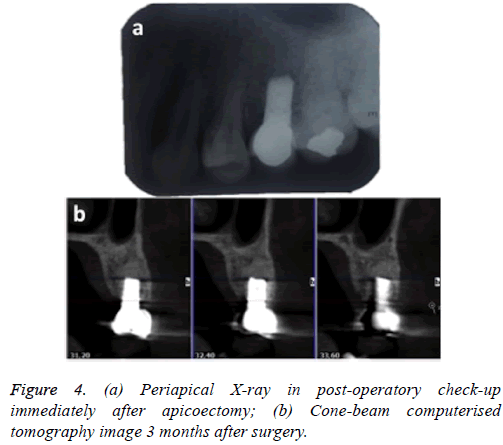 biomedres-monofilament-polyamide