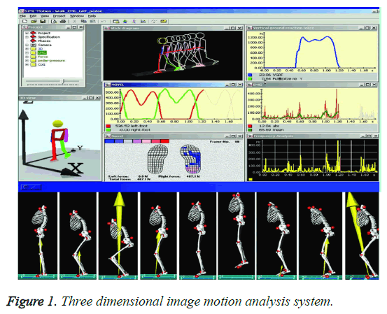 biomedres-motion-analysis-system
