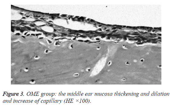 biomedres-mucosa-thickening