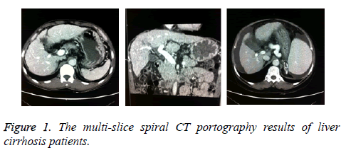 biomedres-multi-slice-spiral