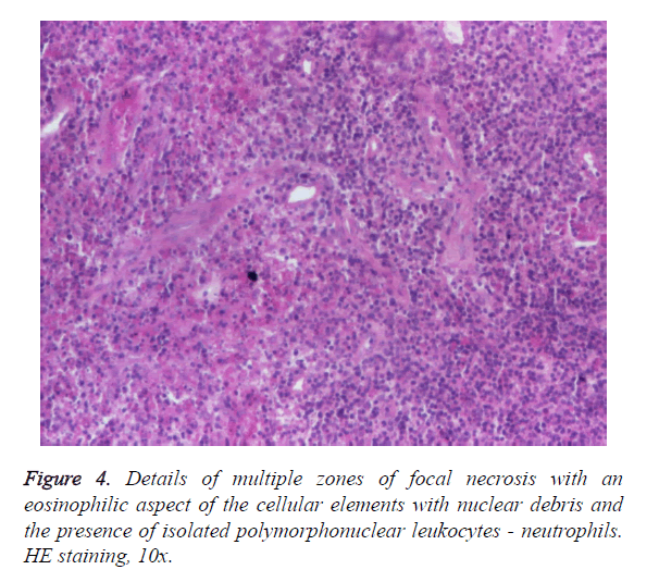 biomedres-multiple-zones-focal