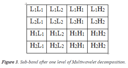 biomedres-multiwavelet-decomposition