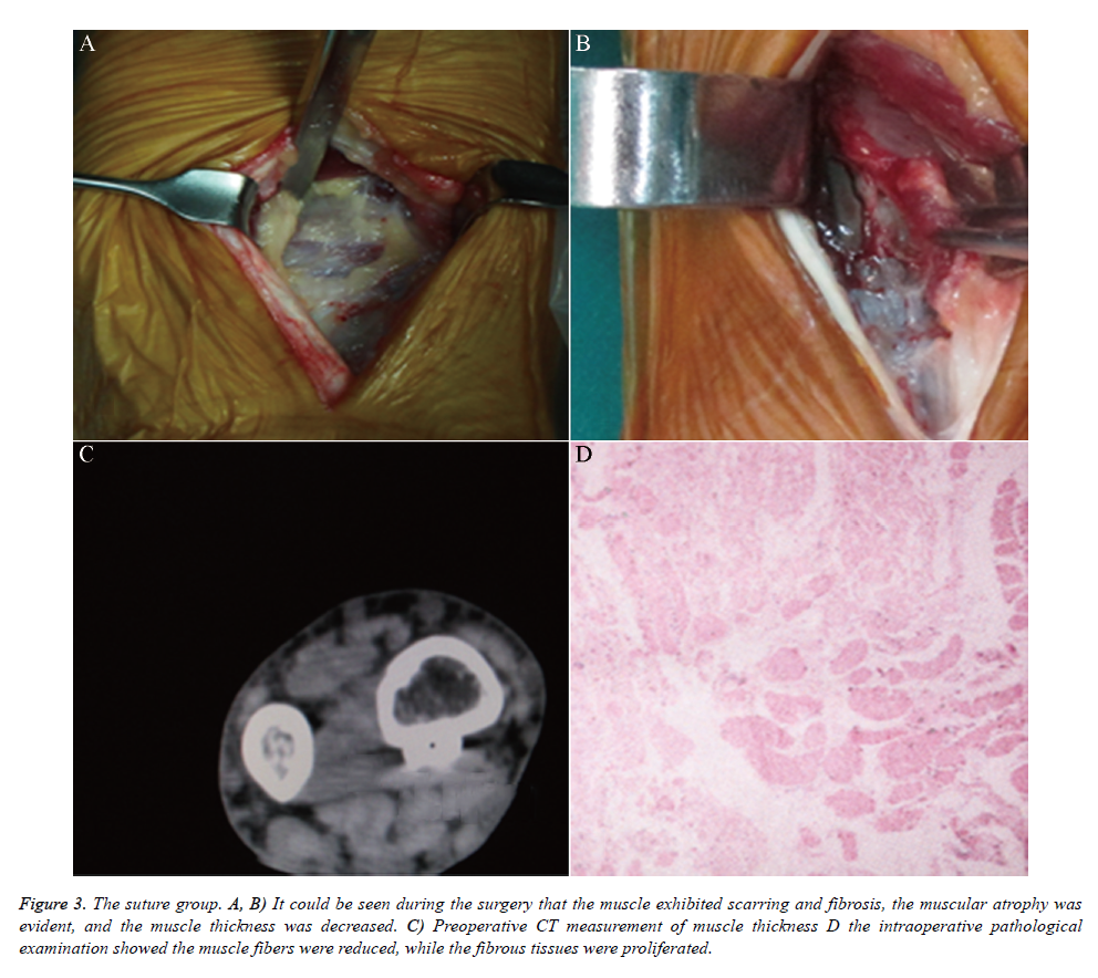 biomedres-muscle-exhibited-scarring