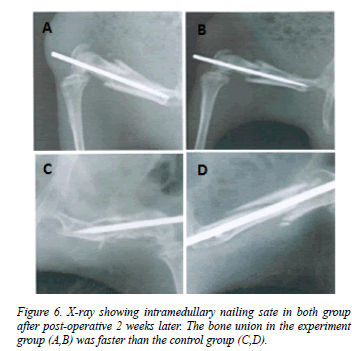 biomedres-nailing-both-group