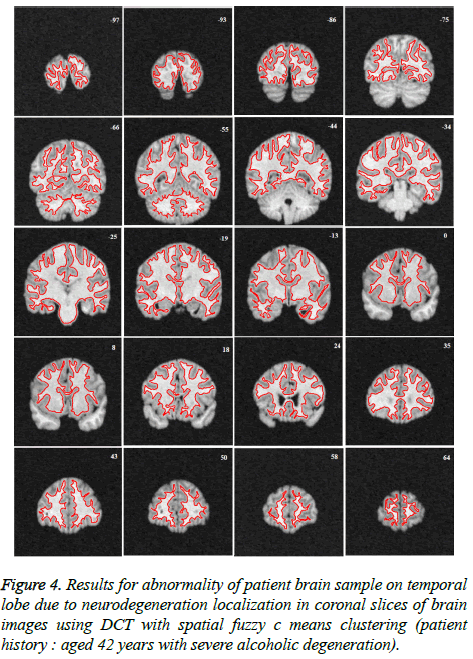 biomedres-neurodegeneration-localization