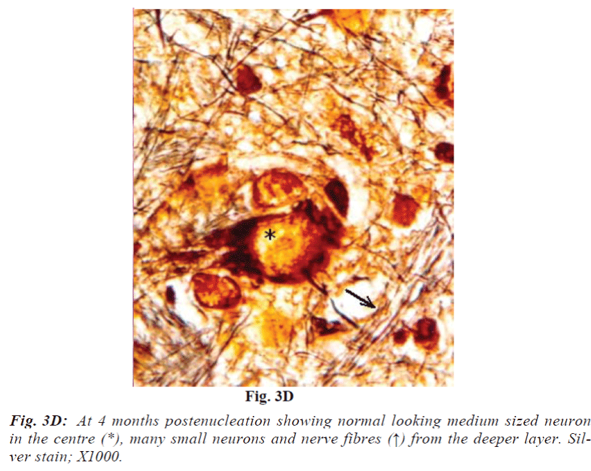 biomedres-neurons-nerve-fibres