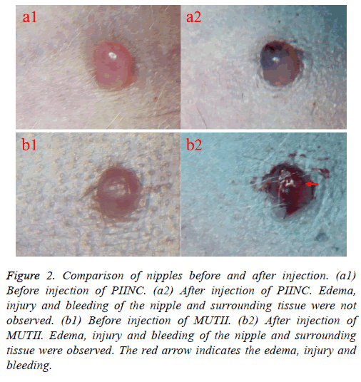biomedres-nipple-bleeding