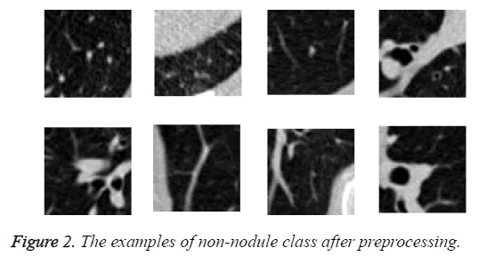 biomedres-non-nodule-class