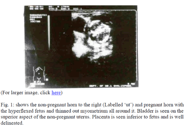 biomedres-non-pregnant