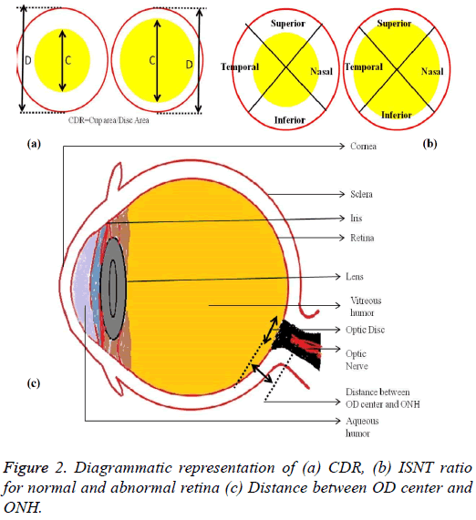 biomedres-normal-abnormal-retina