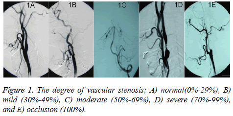 biomedres-occlusion