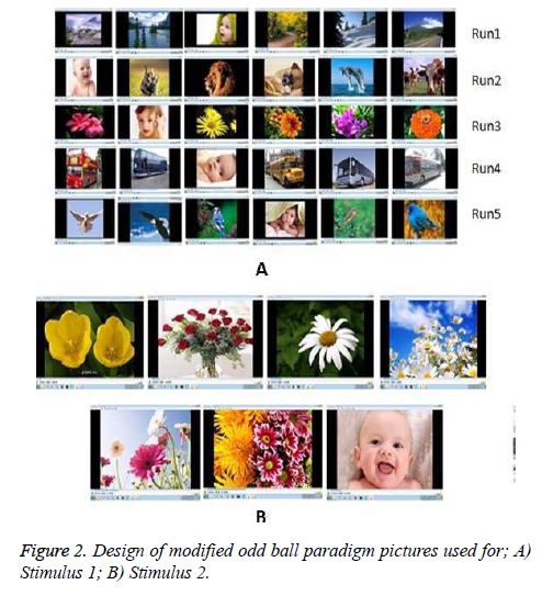 biomedres-odd-ball-paradigm