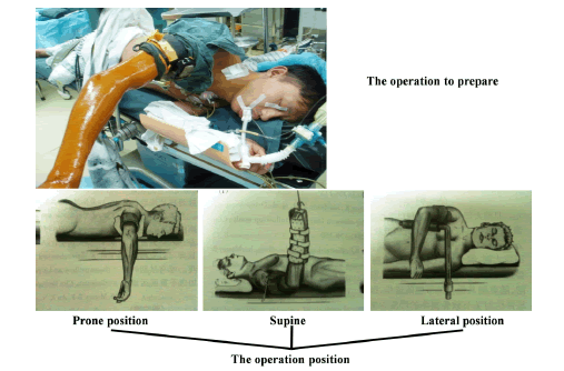 biomedres-operation-prepare