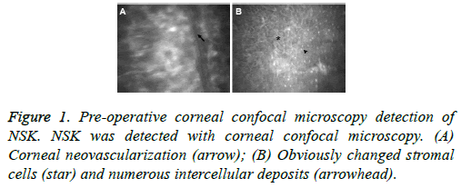 biomedres-operative-corneal