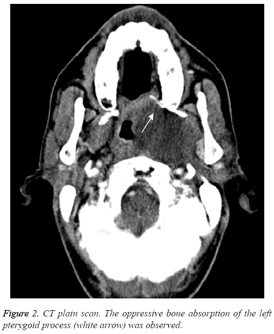 biomedres-oppressive-bone-absorption