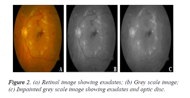 biomedres-optic-disc