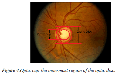 biomedres-optic-disc