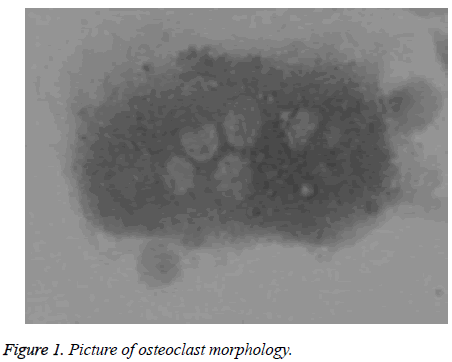 biomedres-osteoclast-morphology