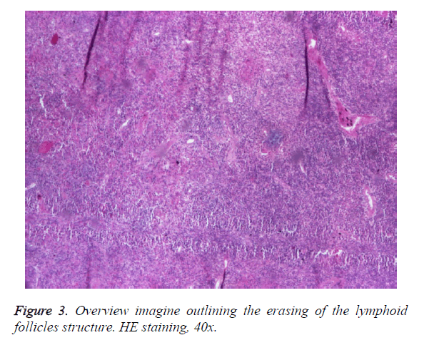 biomedres-outlining-erasing-lymphoid