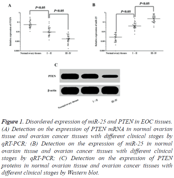 biomedres-ovarian-cancer-tissues