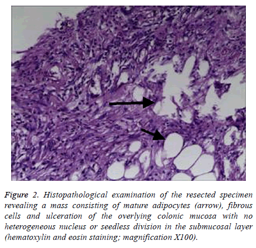 biomedres-overlying-colonic