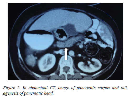 biomedres-pancreatic-corpus