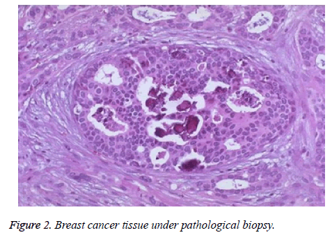 biomedres-pathological-biopsy