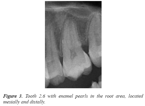 biomedres-pearls-root-area