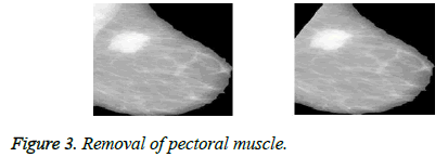 biomedres-pectoral-muscle