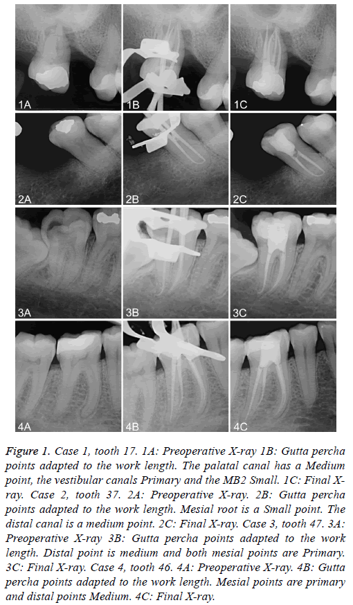 biomedres-percha-points