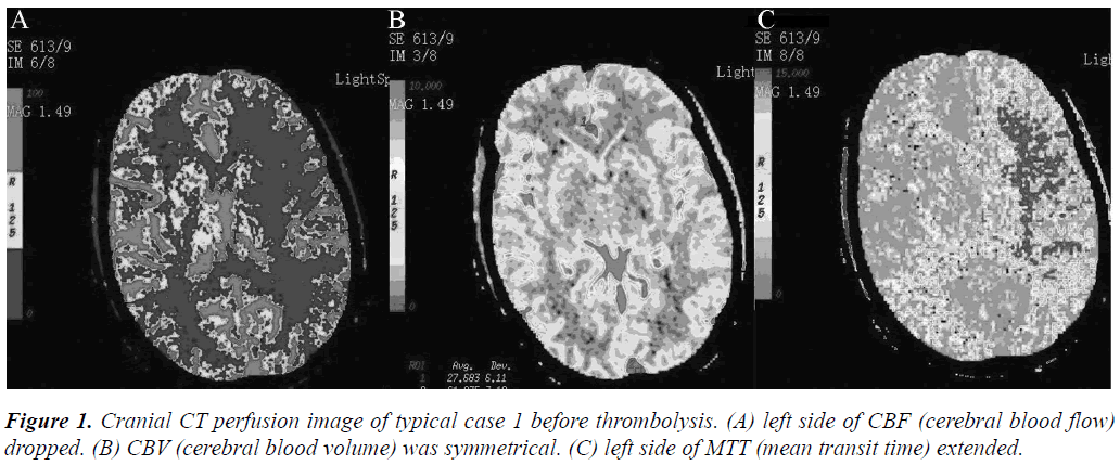 biomedres-perfusion-image