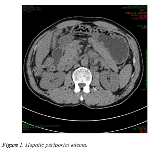 biomedres-periportal-edema