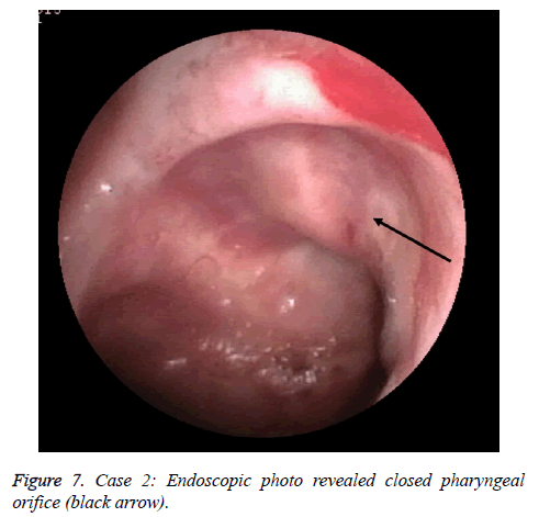 biomedres-pharyngeal