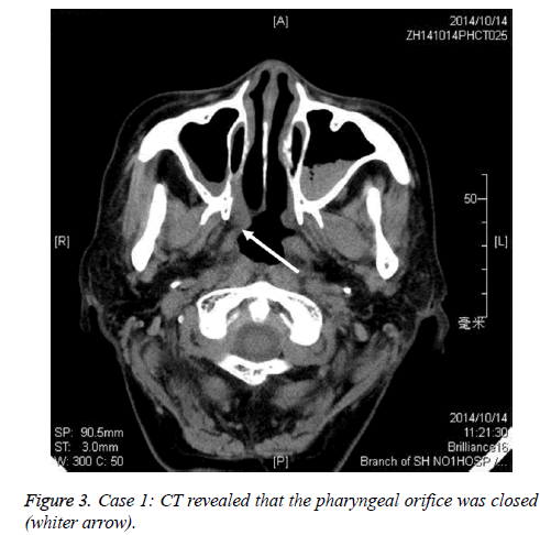 biomedres-pharyngeal-orifice