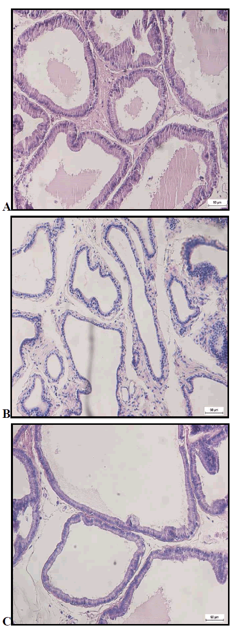 biomedres-photomicrographs-prostate-gland