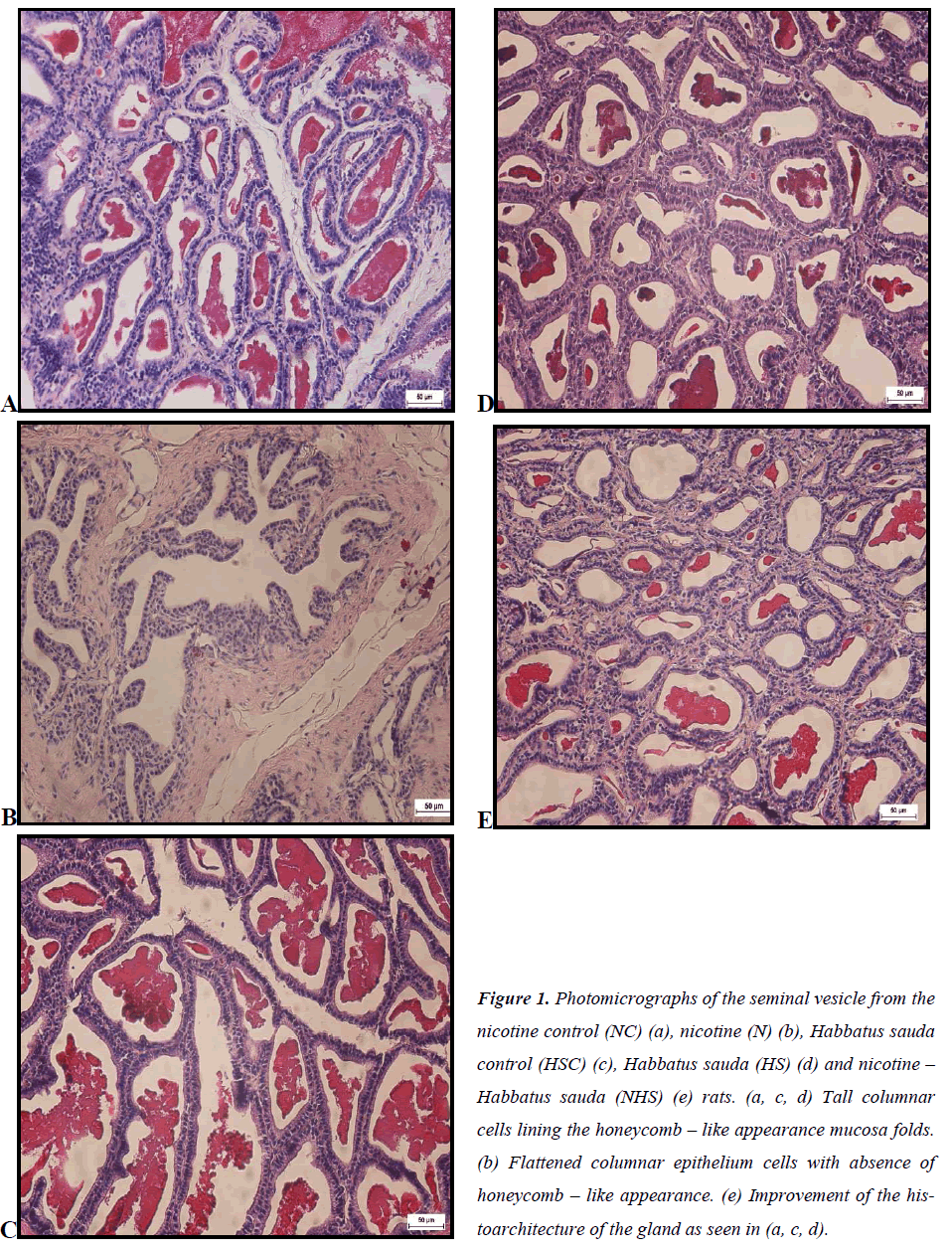 biomedres-photomicrographs-seminal-vesicle