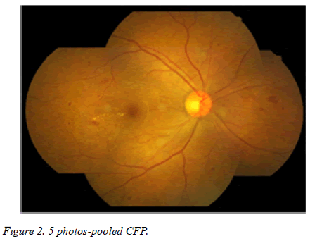 biomedres-photos-pooled-CFP